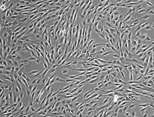 Mesenchymal stem cells (MSCs)